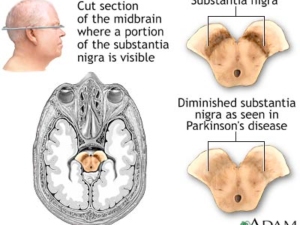 medici neurofisiologia clinica milano Dr. Luigi Giovanni Manfredi